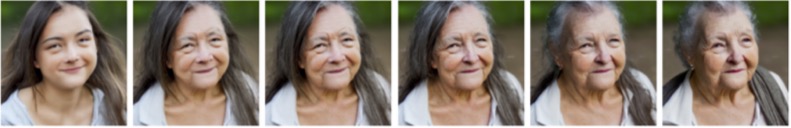 CS with ASTD - Age Comparison